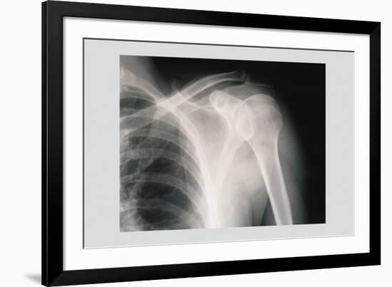 Shoulder-null-Framed Premium Giclee Print