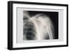 Shoulder-null-Framed Art Print