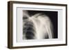 Shoulder-null-Framed Art Print