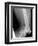 Shrapnel Injury, X-ray-Du Cane Medical-Framed Photographic Print