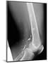 Shrapnel Injury, X-ray-Du Cane Medical-Mounted Photographic Print