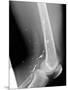 Shrapnel Injury, X-ray-Du Cane Medical-Mounted Photographic Print