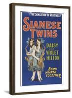 Siamese Twins-null-Framed Art Print