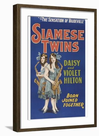 Siamese Twins-null-Framed Art Print