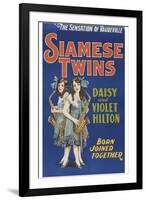 Siamese Twins-null-Framed Art Print