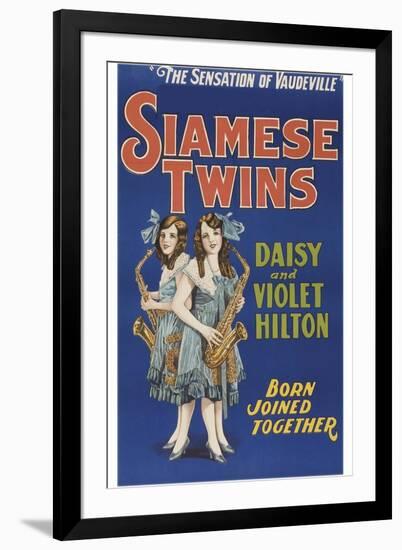 Siamese Twins-null-Framed Art Print
