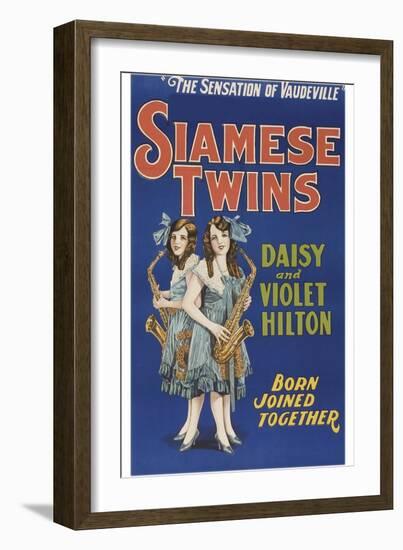 Siamese Twins-null-Framed Art Print