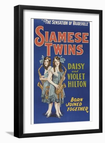 Siamese Twins-null-Framed Art Print