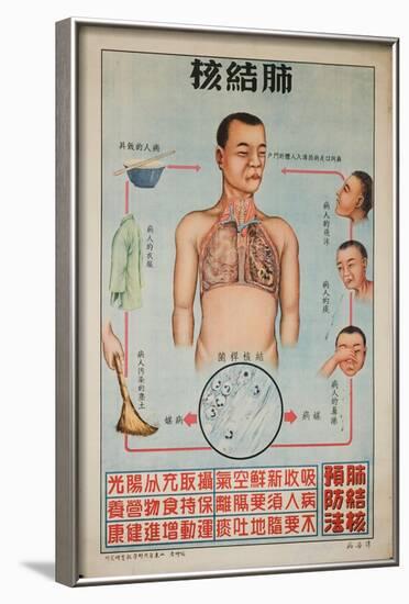 Sick People Can Spread Tb Through Bodily Discharges-null-Framed Art Print