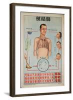 Sick People Can Spread Tb Through Bodily Discharges-null-Framed Art Print