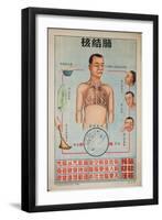 Sick People Can Spread Tb Through Bodily Discharges-null-Framed Art Print