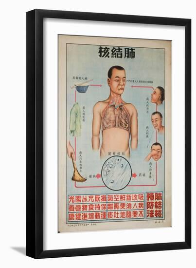 Sick People Can Spread Tb Through Bodily Discharges-null-Framed Art Print