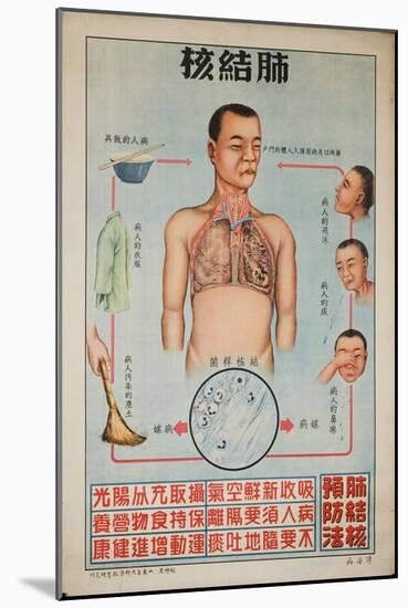 Sick People Can Spread Tb Through Bodily Discharges-null-Mounted Art Print