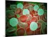 Sickle Cell Anemia with Red Blood Cells and White Bood Cells-null-Mounted Art Print