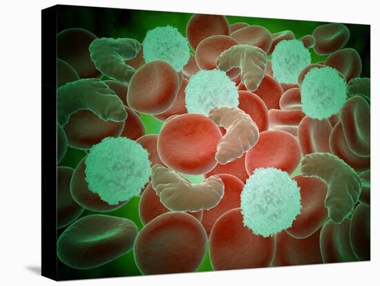 Sickle Cell Anemia with Red Blood Cells and White Bood Cells-null-Stretched Canvas