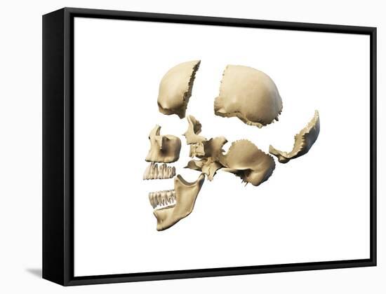 Side View of Human Skull with Parts Exploded-null-Framed Stretched Canvas
