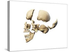 Side View of Human Skull with Parts Exploded-null-Stretched Canvas