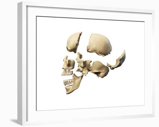 Side View of Human Skull with Parts Exploded-null-Framed Art Print