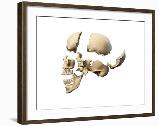 Side View of Human Skull with Parts Exploded-null-Framed Art Print