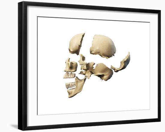Side View of Human Skull with Parts Exploded-null-Framed Art Print