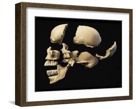 Side View of Human Skull with Parts Exploded-null-Framed Art Print