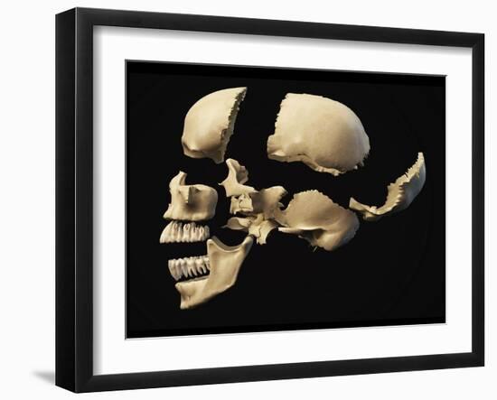 Side View of Human Skull with Parts Exploded-null-Framed Art Print