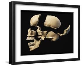 Side View of Human Skull with Parts Exploded-null-Framed Art Print