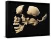 Side View of Human Skull with Parts Exploded-null-Framed Stretched Canvas