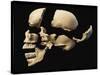 Side View of Human Skull with Parts Exploded-null-Stretched Canvas