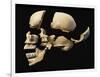 Side View of Human Skull with Parts Exploded-null-Framed Art Print