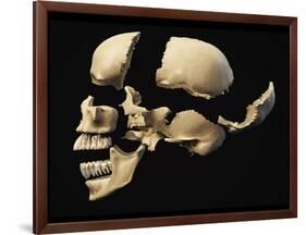 Side View of Human Skull with Parts Exploded-null-Framed Art Print