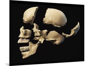 Side View of Human Skull with Parts Exploded-null-Mounted Art Print