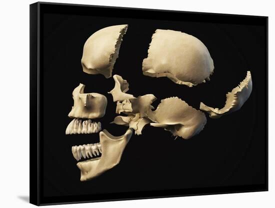 Side View of Human Skull with Parts Exploded-null-Framed Stretched Canvas