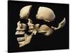 Side View of Human Skull with Parts Exploded-null-Stretched Canvas