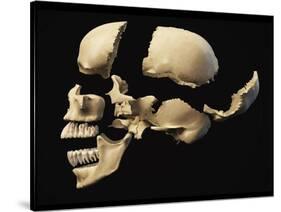 Side View of Human Skull with Parts Exploded-null-Stretched Canvas