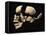 Side View of Human Skull with Parts Exploded-null-Framed Stretched Canvas