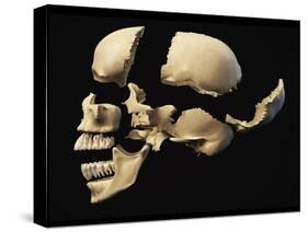 Side View of Human Skull with Parts Exploded-null-Stretched Canvas