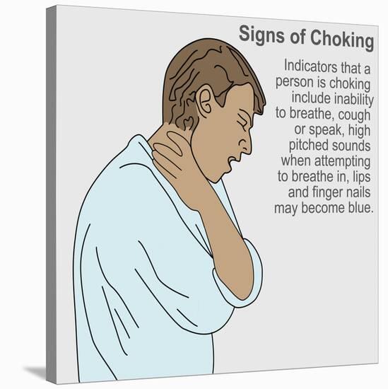 Signs of Choking-Gwen Shockey-Stretched Canvas