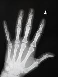 Hand Bones-Simon Jarratt-Premium Photographic Print