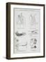 Simple Methods Of Bandaging-Isabella Beeton-Framed Giclee Print