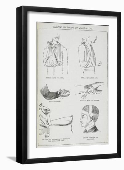 Simple Methods Of Bandaging-Isabella Beeton-Framed Giclee Print