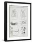 Simple Methods Of Bandaging-Isabella Beeton-Framed Giclee Print