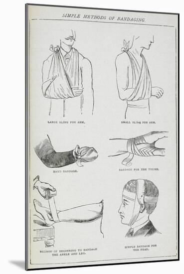 Simple Methods Of Bandaging-Isabella Beeton-Mounted Giclee Print