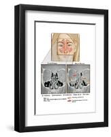 Sinuses and Sinusitis-Science Source-Framed Art Print