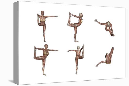 Six Different Views of Dancer Yoga Pose Showing Female Musculature-null-Stretched Canvas