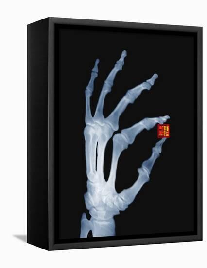 Skeletal Hand Holding Computer Chip-Charles O'Rear-Framed Stretched Canvas