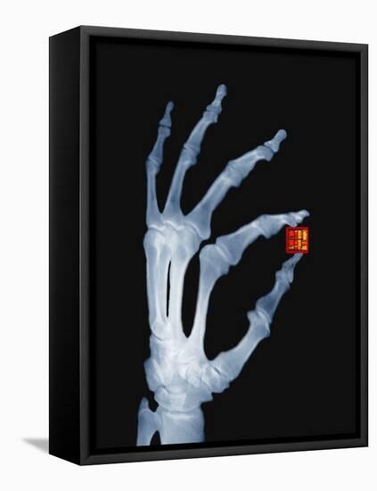 Skeletal Hand Holding Computer Chip-Charles O'Rear-Framed Stretched Canvas