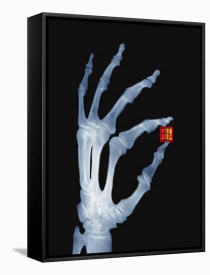 Skeletal Hand Holding Computer Chip-Charles O'Rear-Framed Stretched Canvas