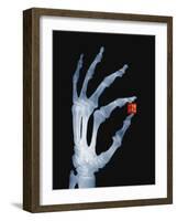 Skeletal Hand Holding Computer Chip-Charles O'Rear-Framed Photographic Print