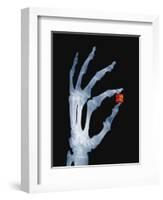 Skeletal Hand Holding Computer Chip-Charles O'Rear-Framed Photographic Print